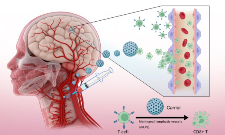 brain inflamation